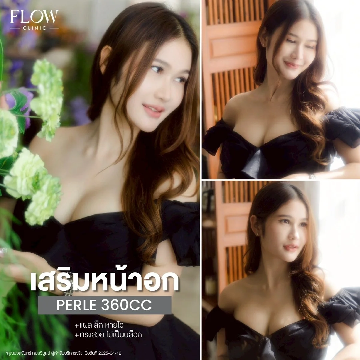 LINE_ALBUM_รีวิวเสริมหน้าอก_250827_4.jpg
