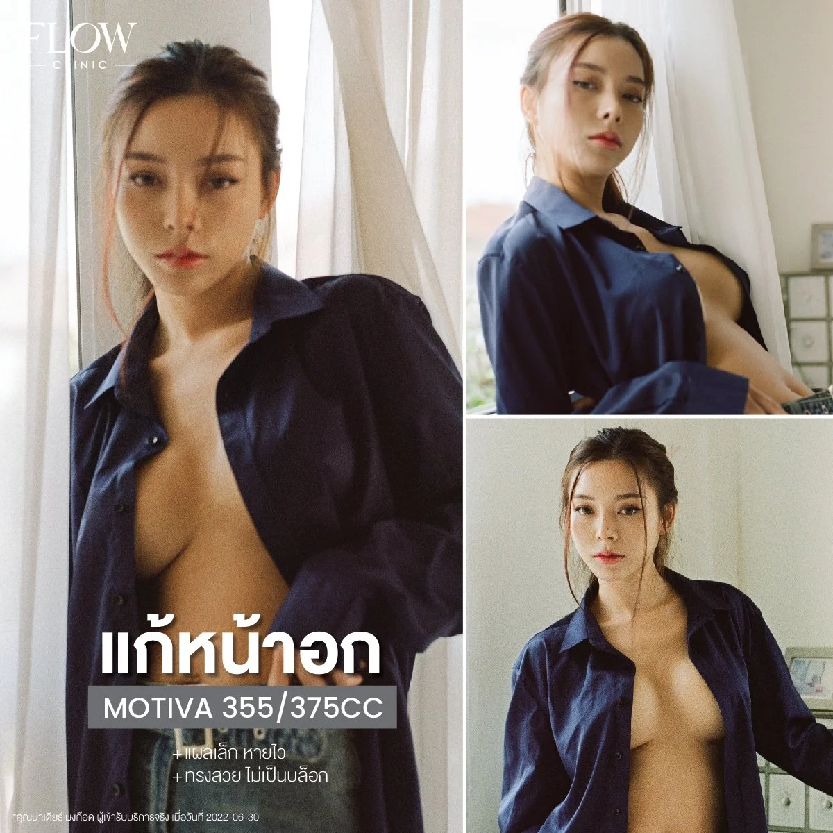 LINE_ALBUM_รีวิวเสริมหน้าอก_250827_12.jpg