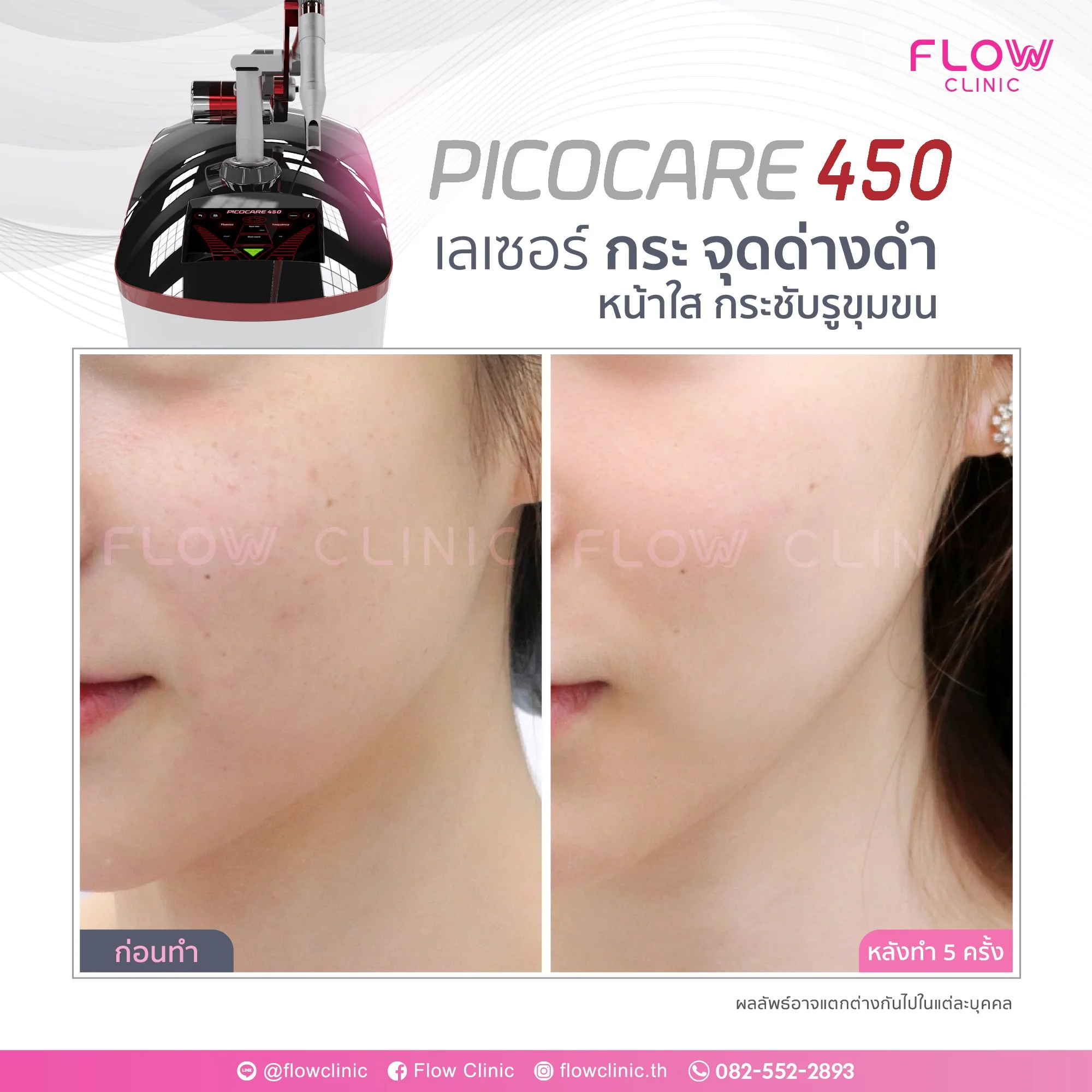 review-Flow-Picocare-01-01.jpg