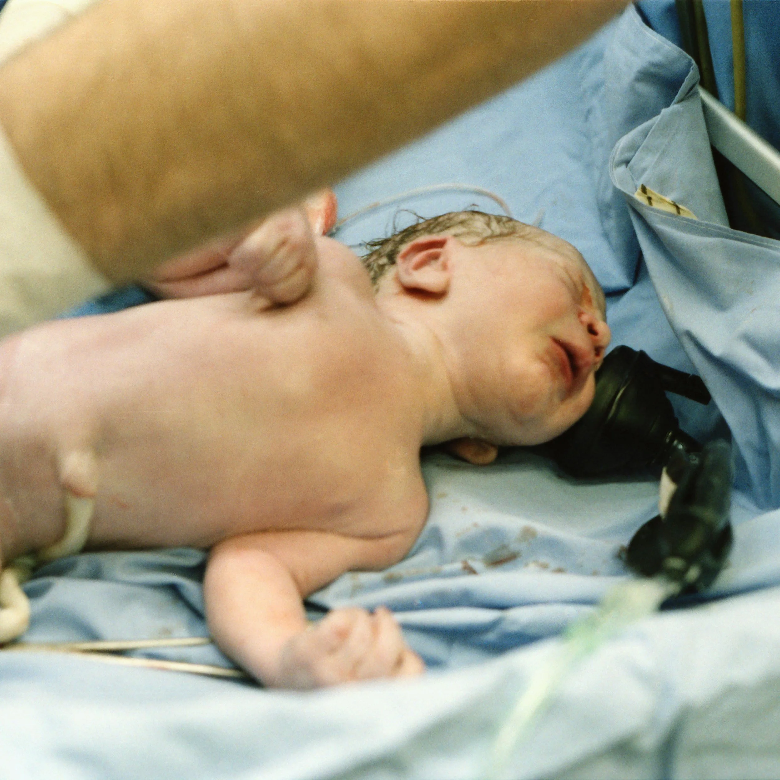 Newborn baby receiving care from medical staff recently after being born