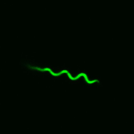 gfp-borrelia.jpg