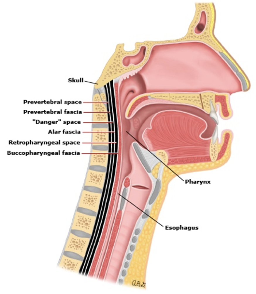 Retropharyngeal abscess — Emergency Medicine Board Review