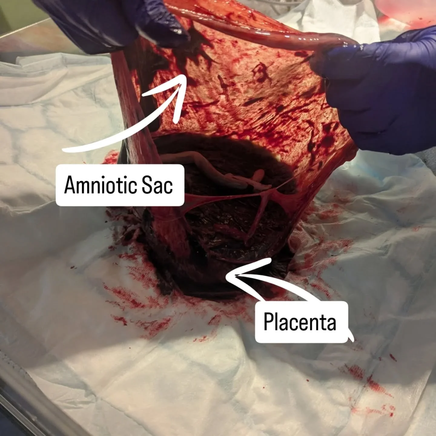 LOOK AT PLACENTA 👀

I think placentas are incredible!