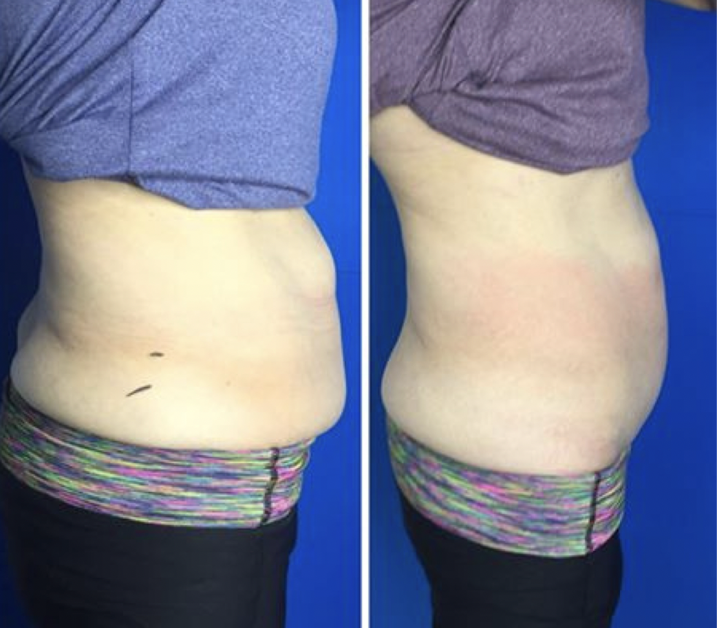 Screen Shot 2022-06-09 at 9.28.05 AM.png