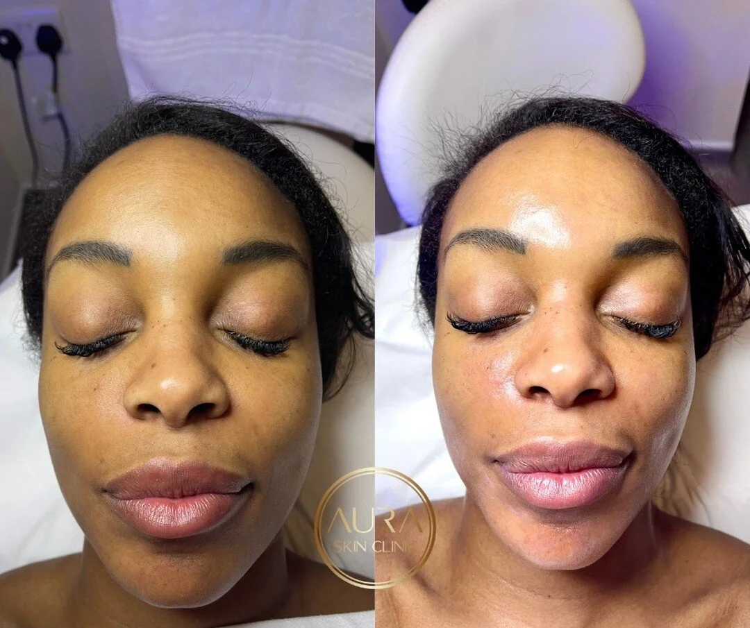 Aura Skin Clinic