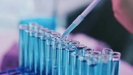 Update on autoimmune testing