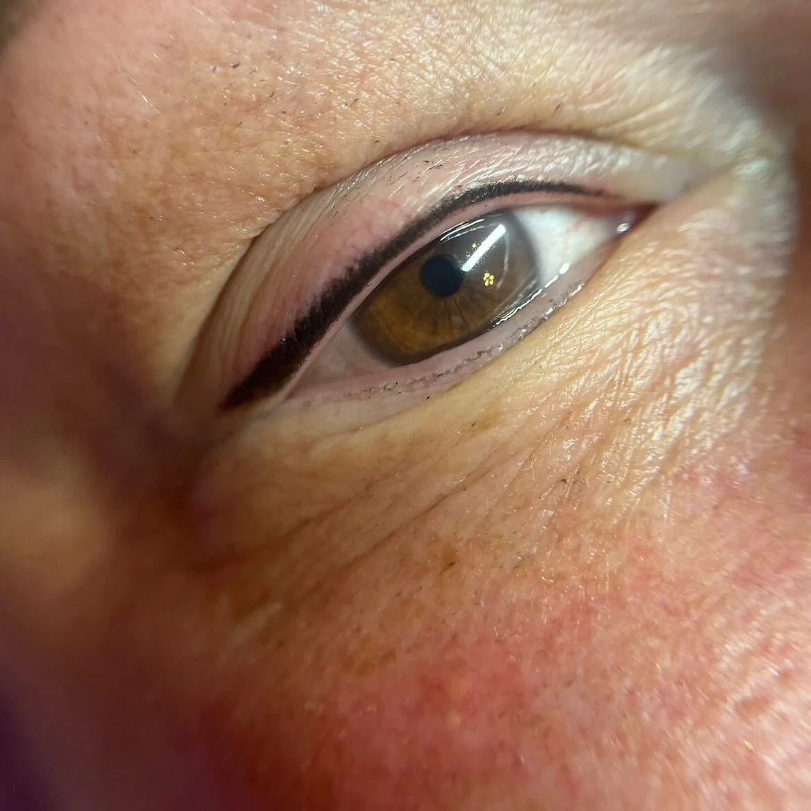 Restore Confidence With Cosmetic and Paramedical Tattooing for Alopecia and Hair Loss