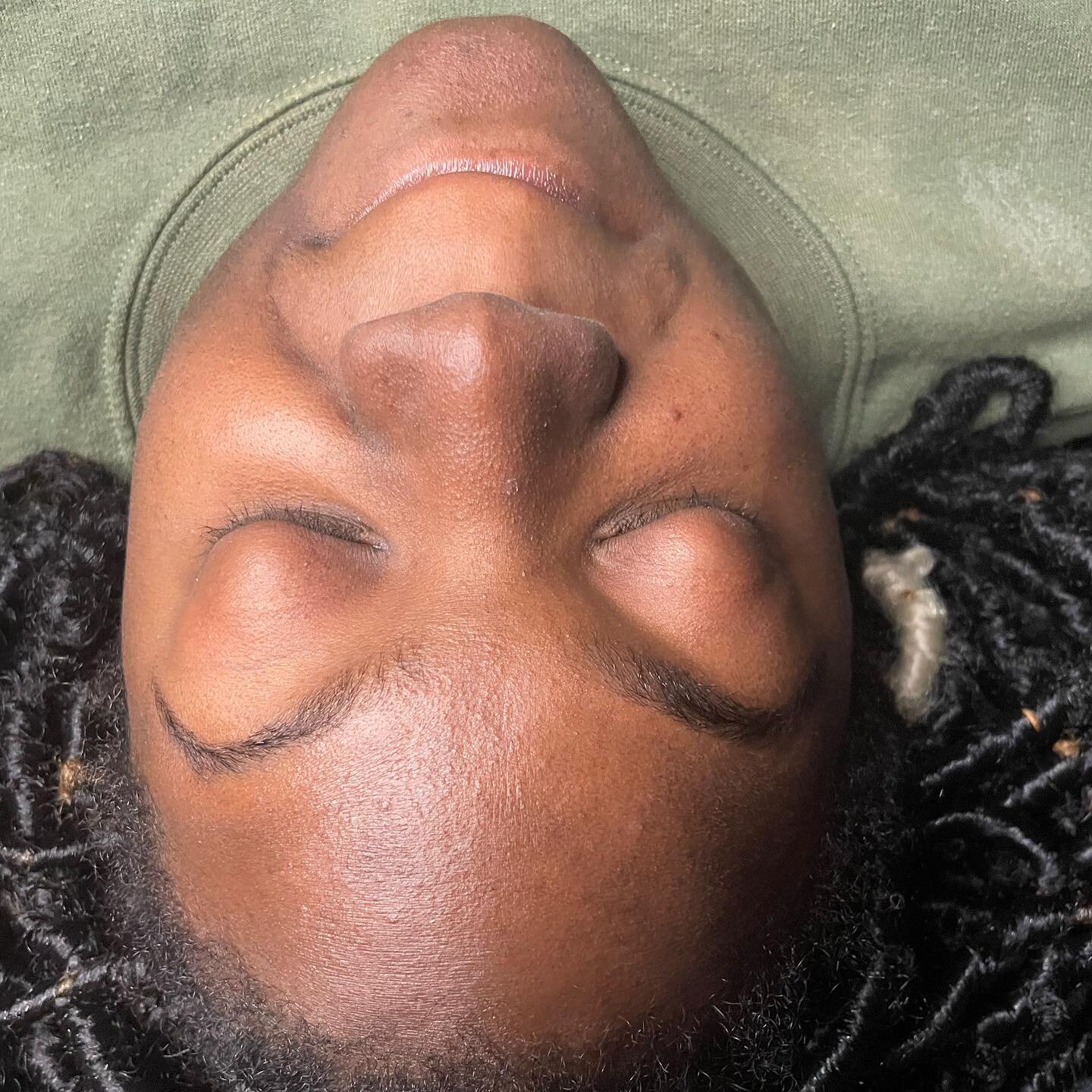 Before and after a Customized Facial with a Dermaplane spot treatment.
.
. 
.
#skincarespecialist #conyersspa #covington #conyersesthetician #conyers #lithonia #decatur #stockbridge #houseofpampering #conyerstattoo #revivesalonsuites #esthetician #co
