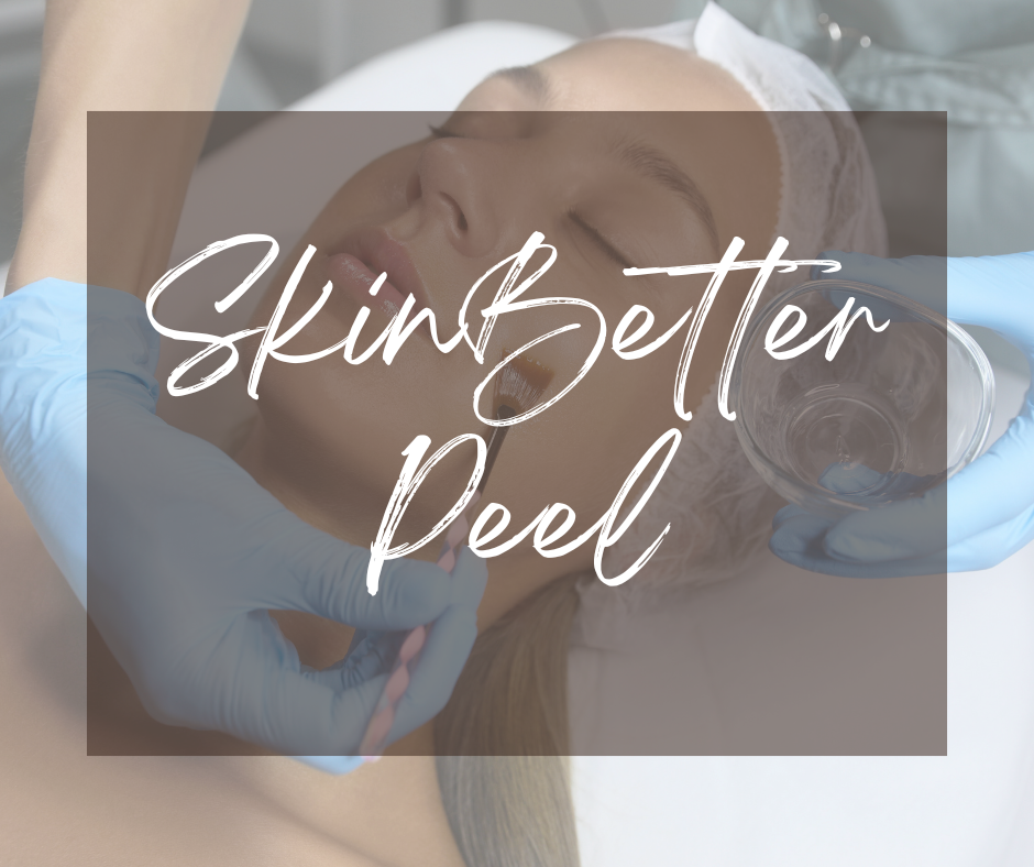 A woman receiving a Skinbetter Facial peel with eyes closed and "skinbetter peel" overlaid on the top.