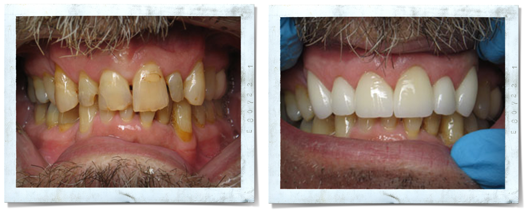 Services — Cullman Cosmetic & Family Dentist Invisalign Dental Implant