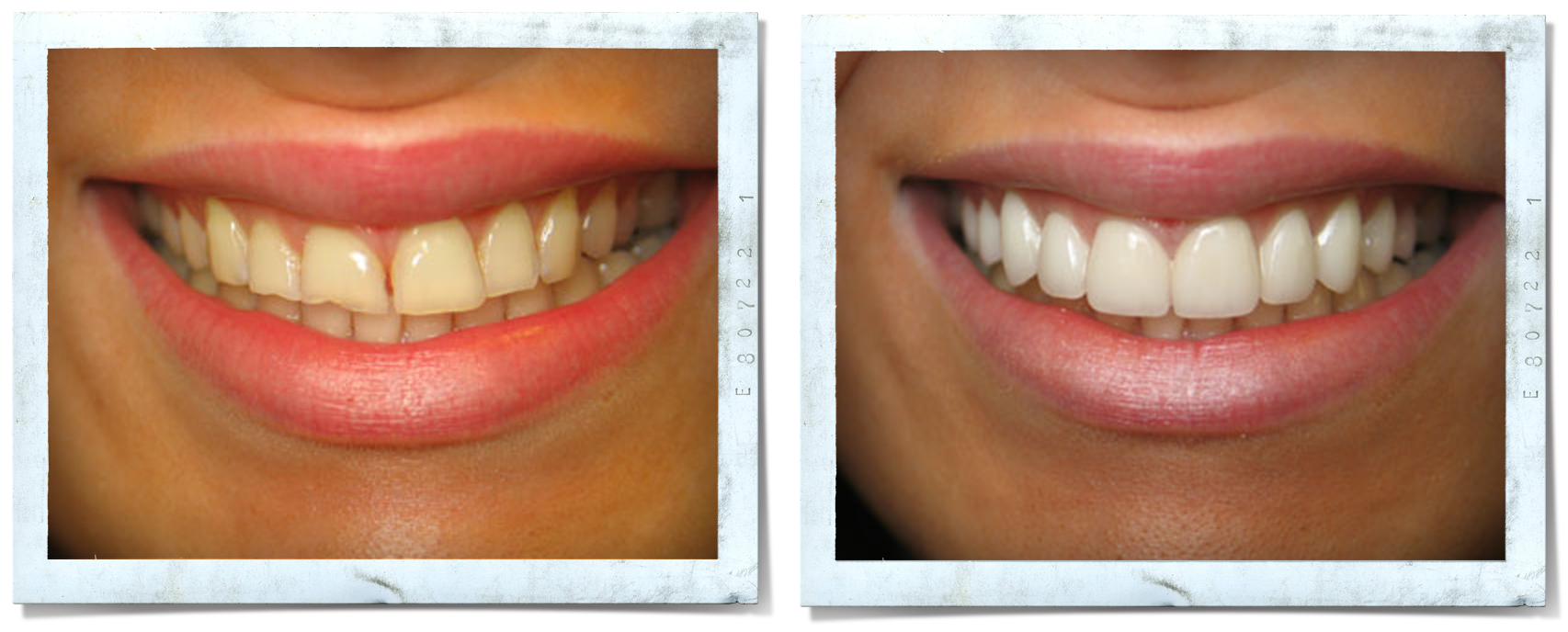 Services — Cullman Cosmetic & Family Dentist Invisalign Dental Implant