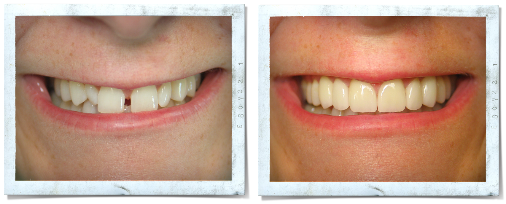 Services — Cullman Cosmetic & Family Dentist Invisalign Dental Implant