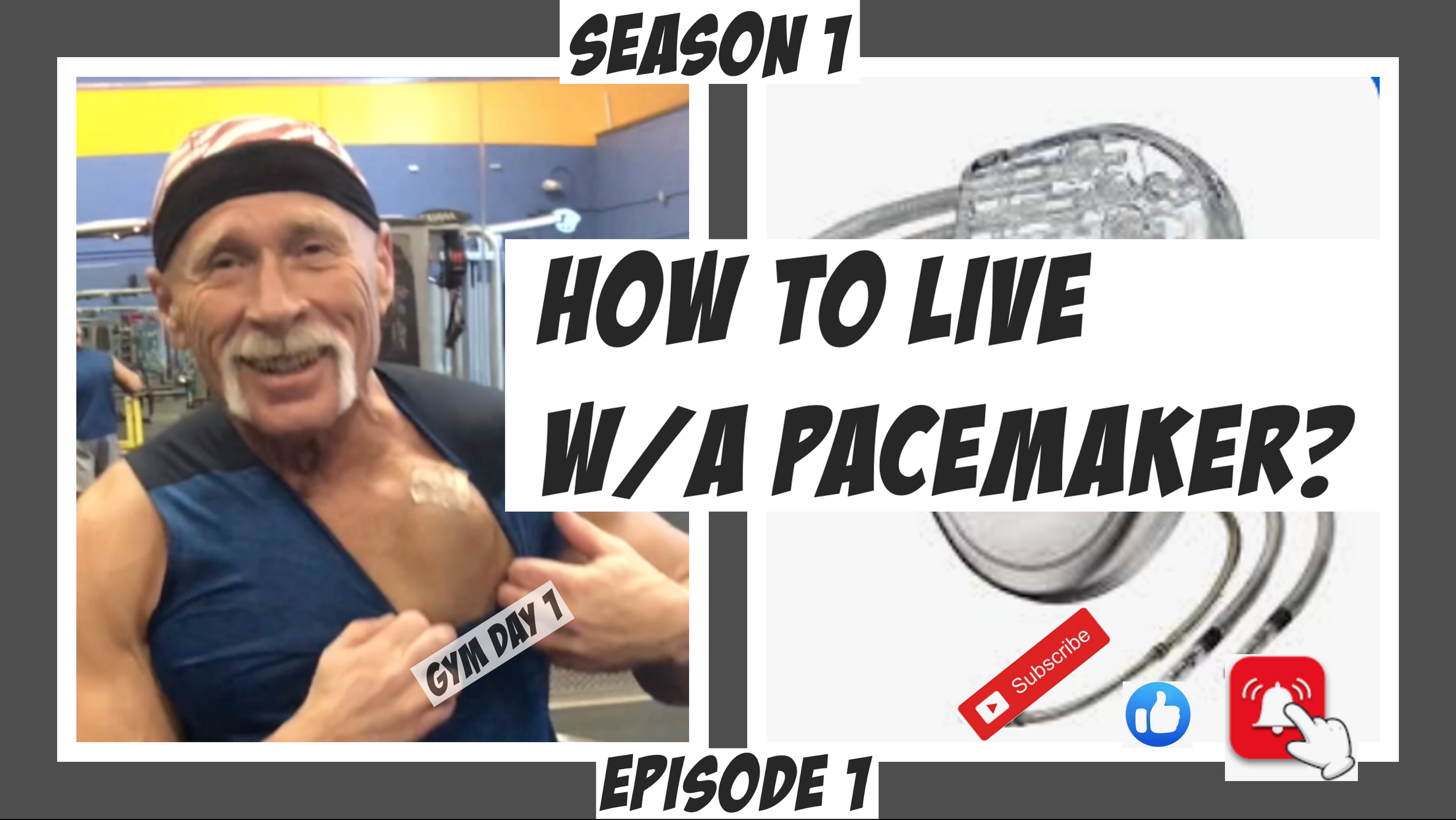 How to live with a pacemaker 2022?.png