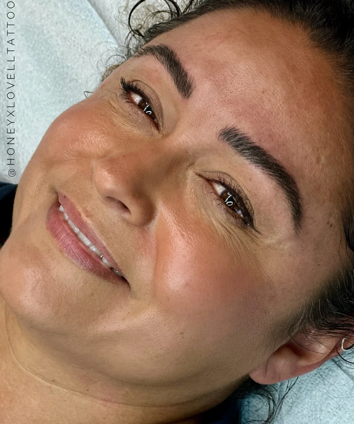A split-screen photo showing a woman smiling broadly in the top half and with a neutral expression in the bottom half, highlighting her teeth and facial features.