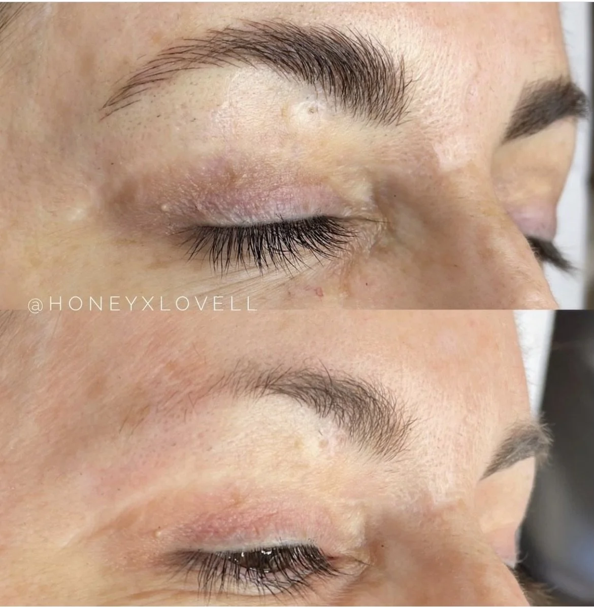 Close-up of a person's closed eye showing before and after eyelash extension application, with visible skin and eyebrows.