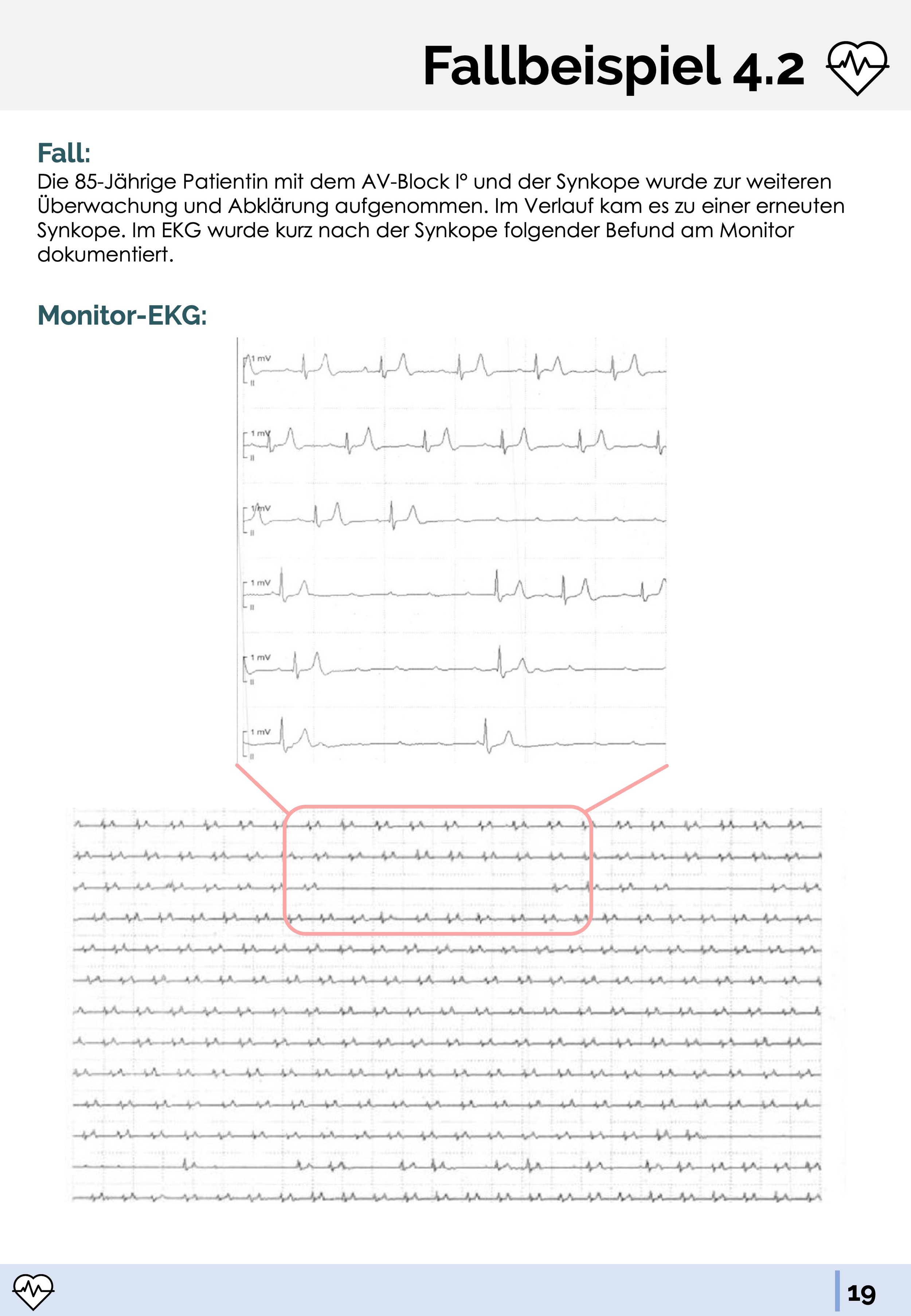 Ekg Beurteilung 7 Fragen Medi Know - Medizinskripte