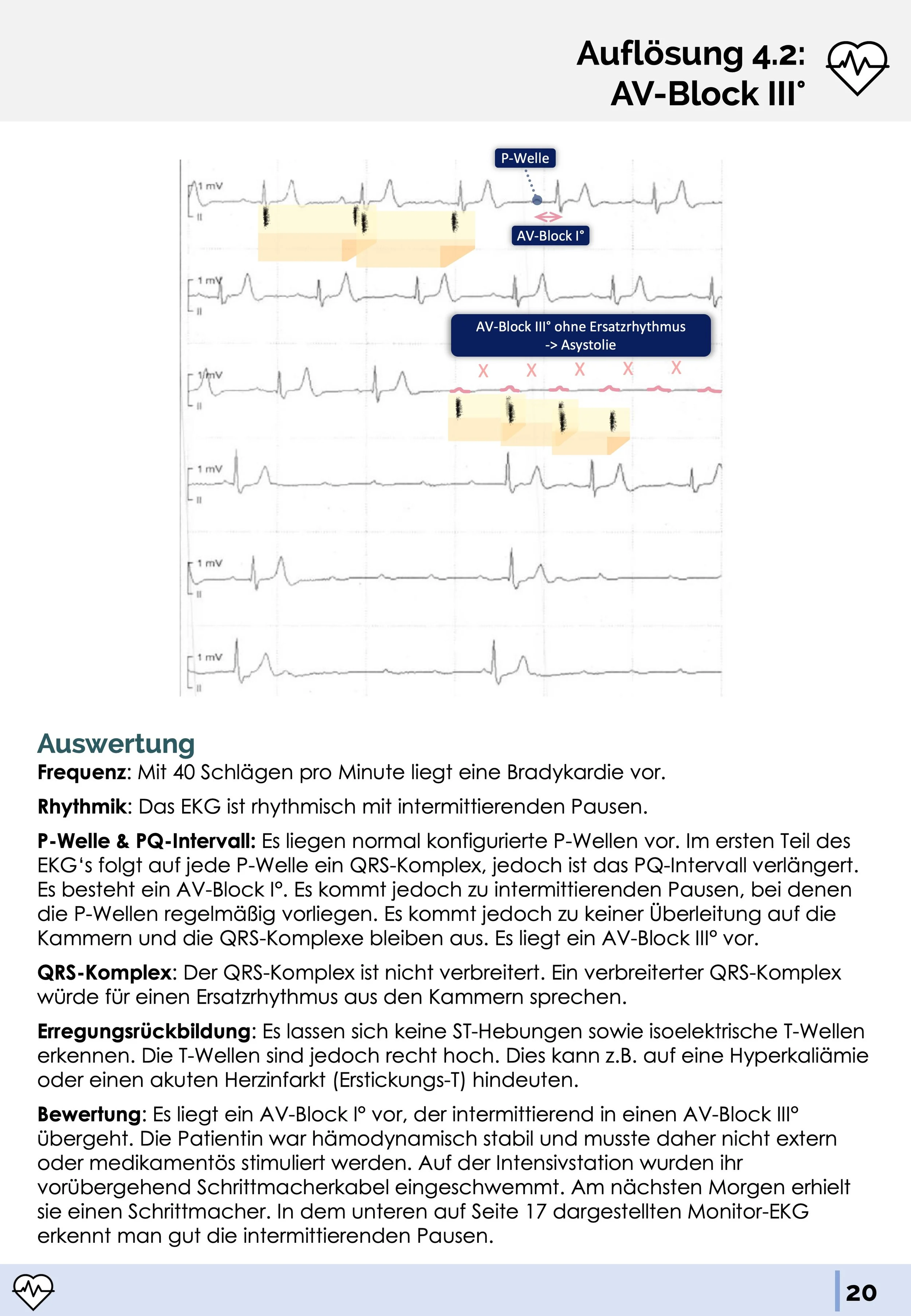 Ekg Beurteilung 7 Fragen Medi Know - Medizinskripte