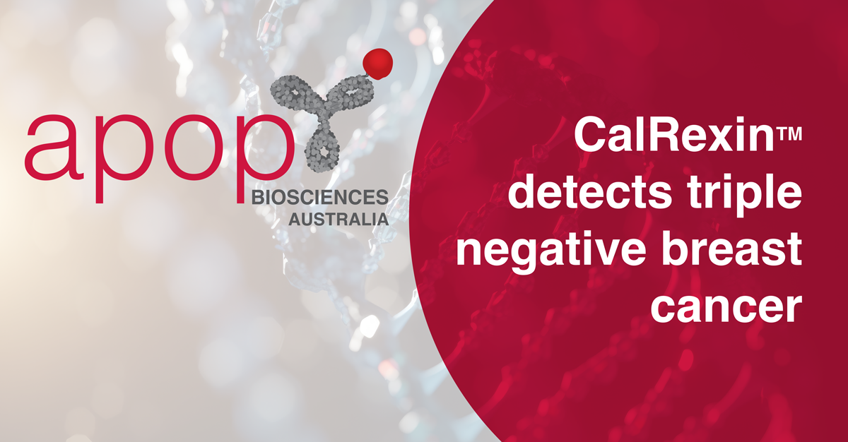 Calcitonin Receptor is a novel biomarker for NF-κB-mediated cellular stress in triple-negative breast cancer cells