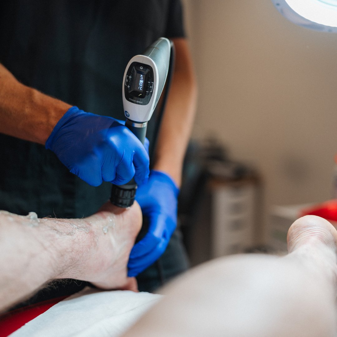 Shockwave Therapy for Foot Pain: Could This Treatment Help You Walk Without Pain Again?