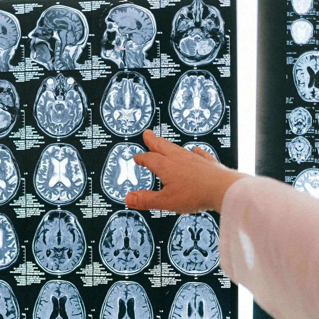 Your Brain on Habit