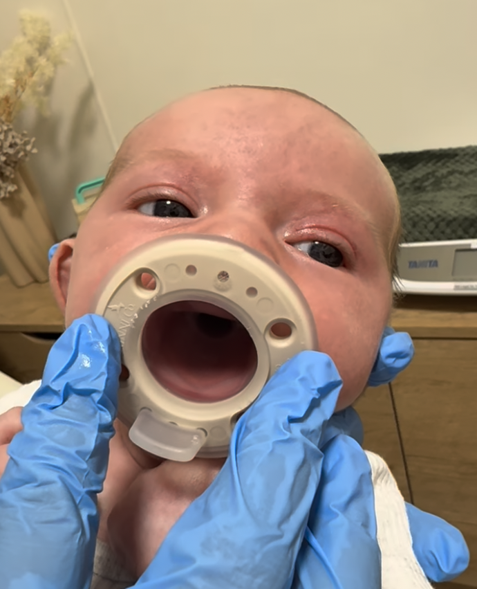 Best Dummy (Pacifier) for a Breastfed Baby: A Midwife &amp; IBCLC’s Evidence-Informed Guide