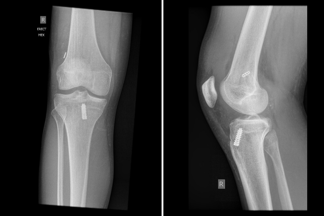 Hobart Knee Centre. Bulk Billing. Affordable Knee Surgery Tasmania