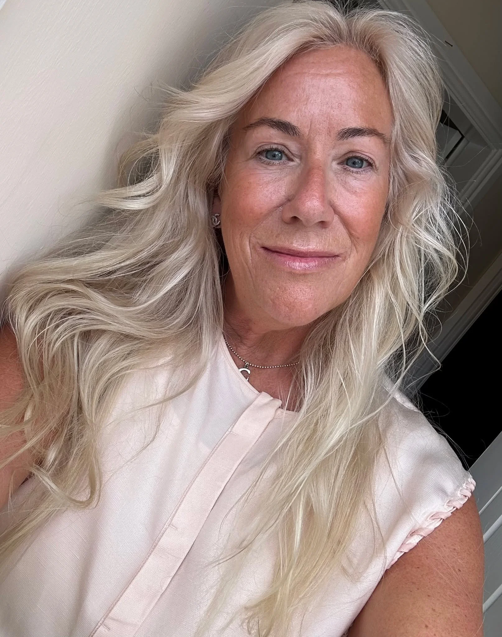 Caroline&rsquo;s Story: Diagnosed at 47
A photographer. A mum of two. A breast cancer survivor.

Caroline had never heard of breast density &mdash; until it nearly cost her life. Her first mammogram missed her tumour because of dense breast tissue.

