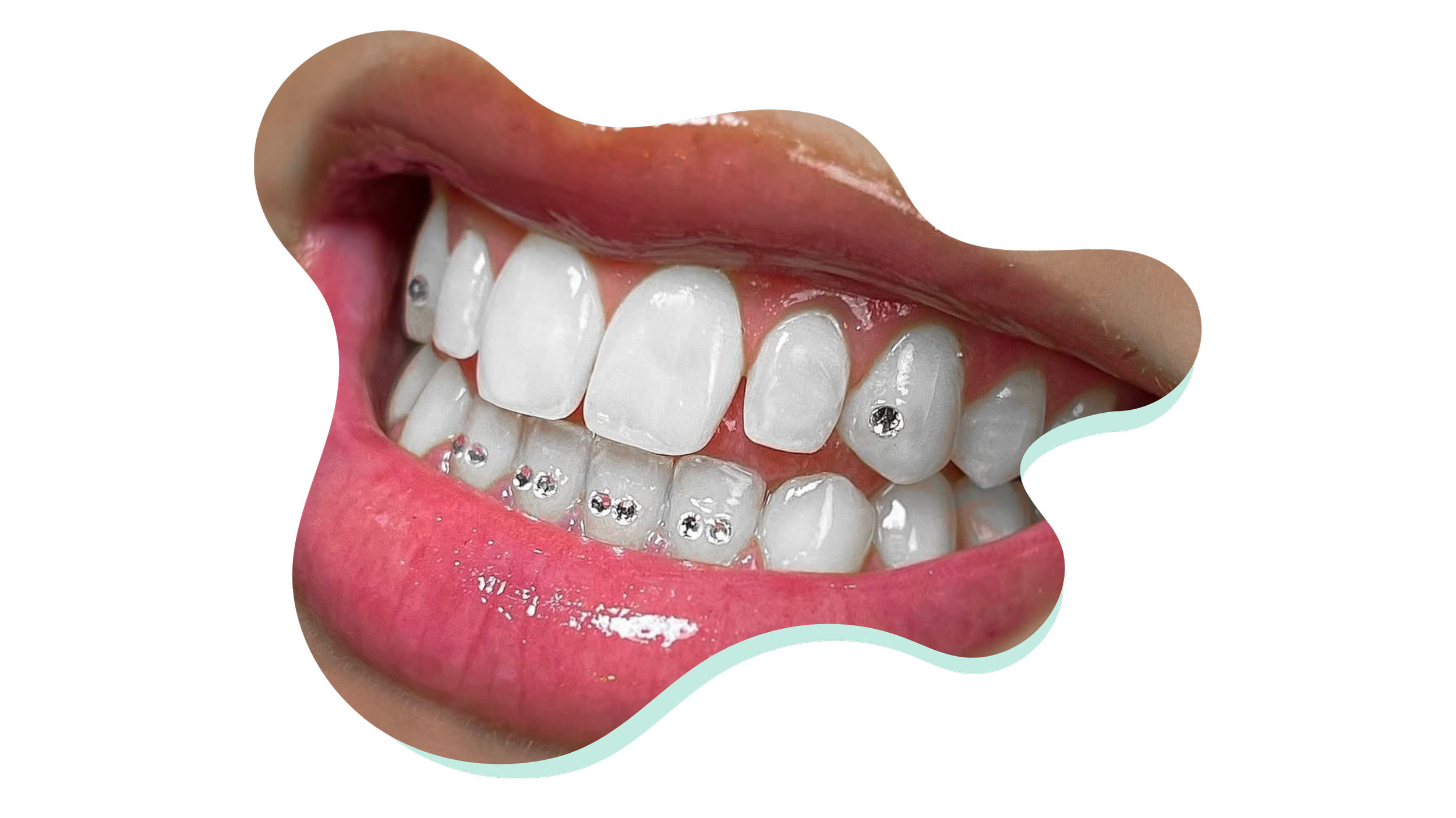 Spring Tooth Nh Enchanted Smiles | Professional Teeth Whitening & Tooth Gems in Dover NH