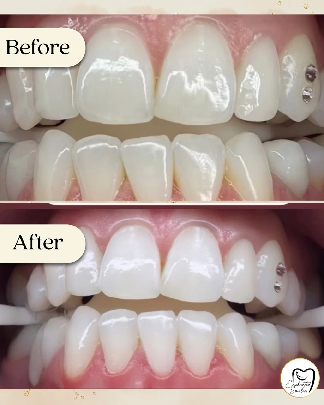 🌟Transformation Touch-up💫

🗺 Do you live in New Hampshire? 
🌊 Are you familiar with the Seacoast or close to Hampton, Exeter, Portsmouth, Dover, and Rochester areas? 
🦷 Interested in professional teeth whitening?
👉🏼Come check out our amazing s