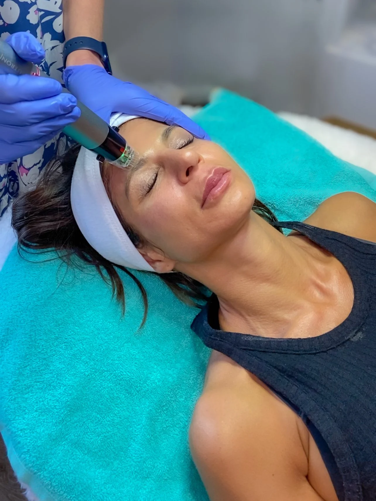 MICRONEEDLING PEN WRENTHAM