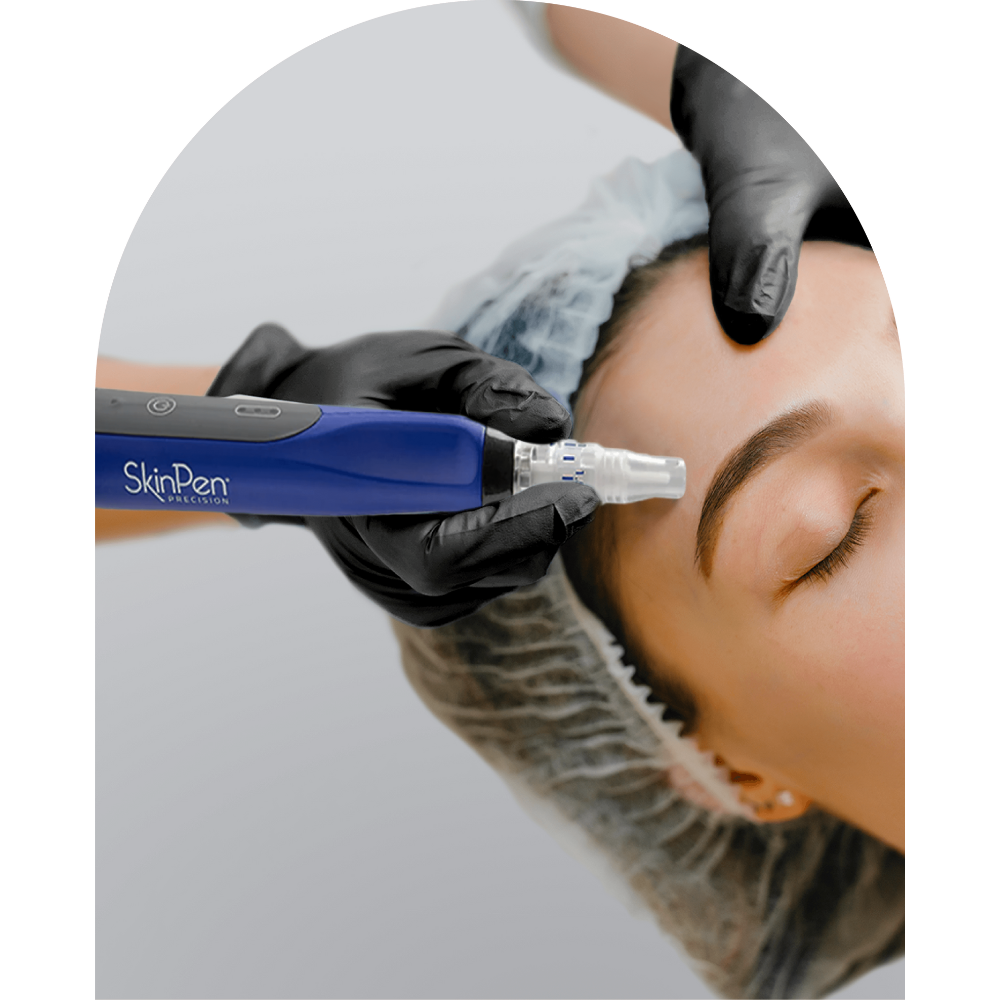 Illustration of a woman receiving a SkinPen Microneedling treatment