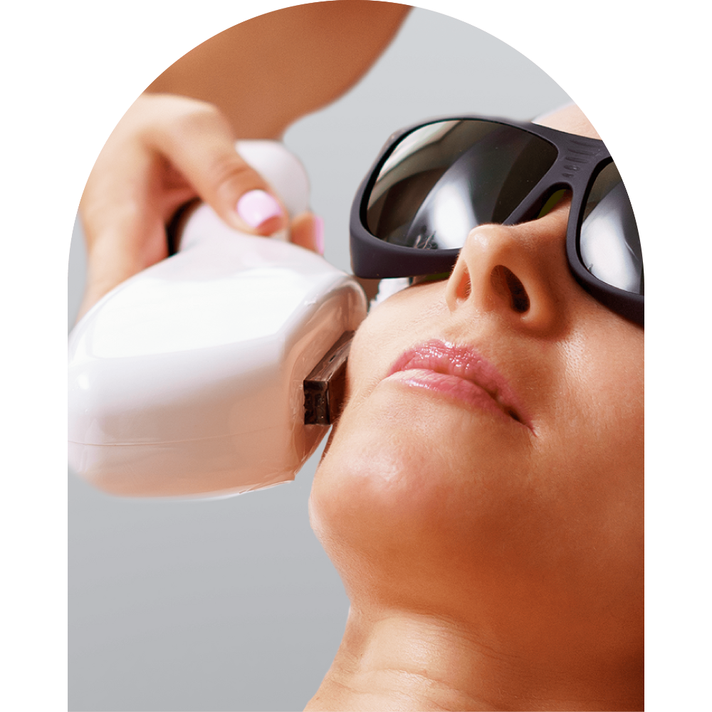 Illustration of a woman receiving Lumecca IPL Facial Treatment