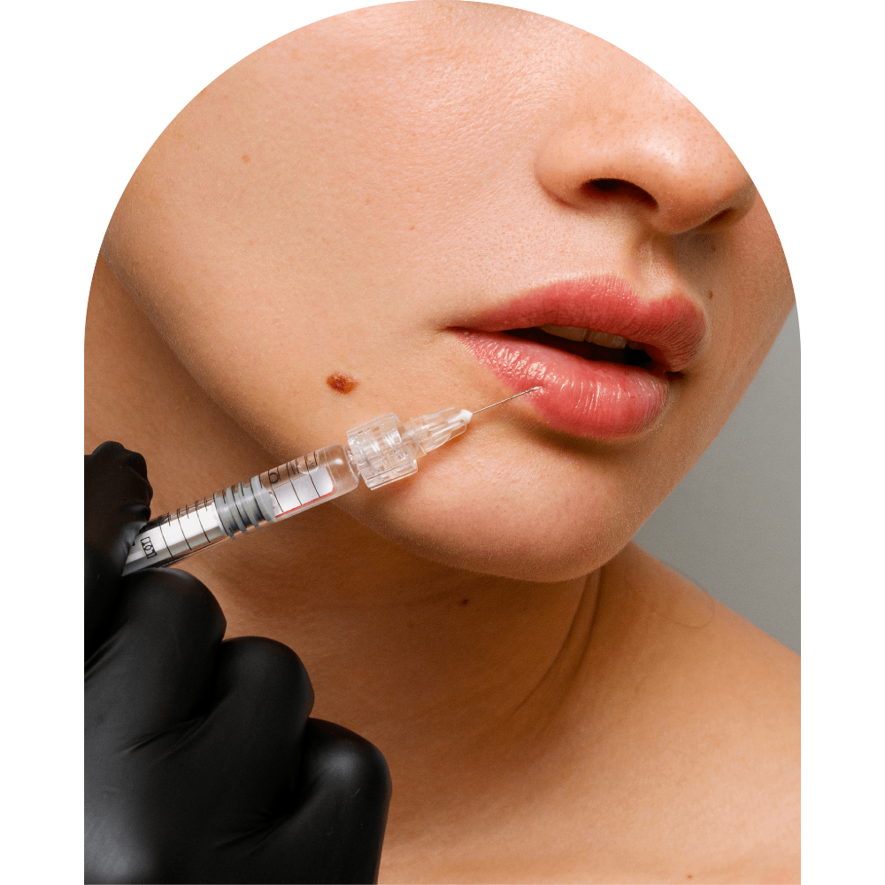 Illustration of a woman receiving a Dermal Filler injection