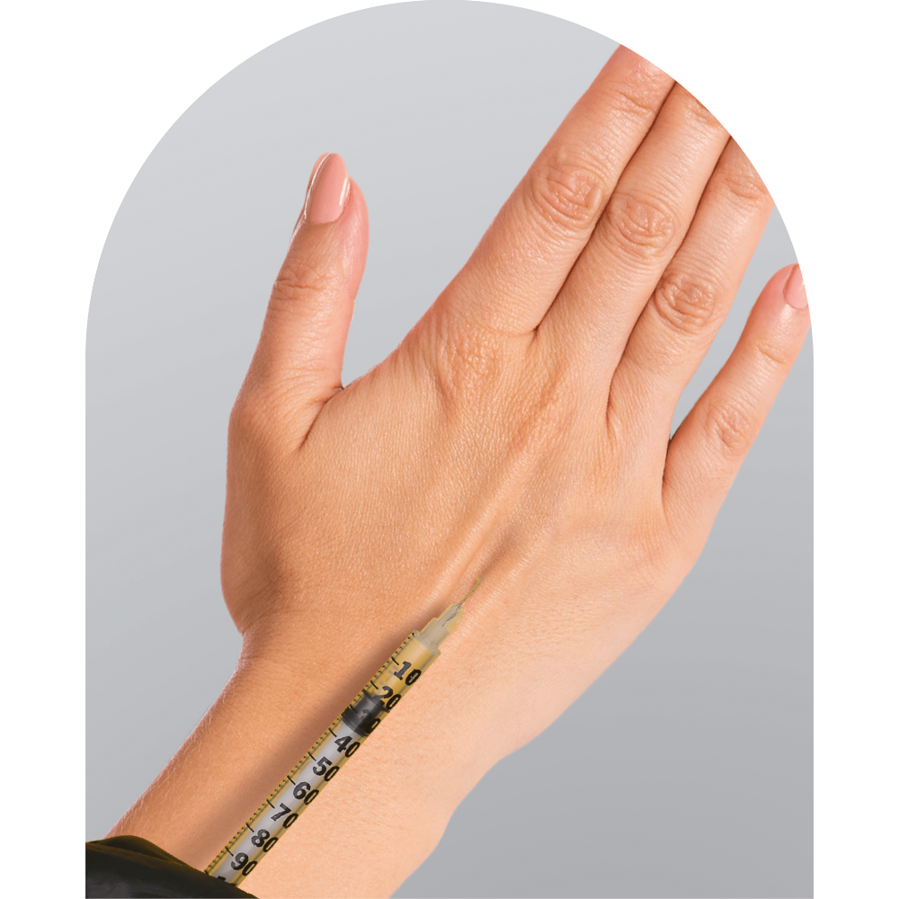 Illustration of a Radiesse Filler hand treatment
