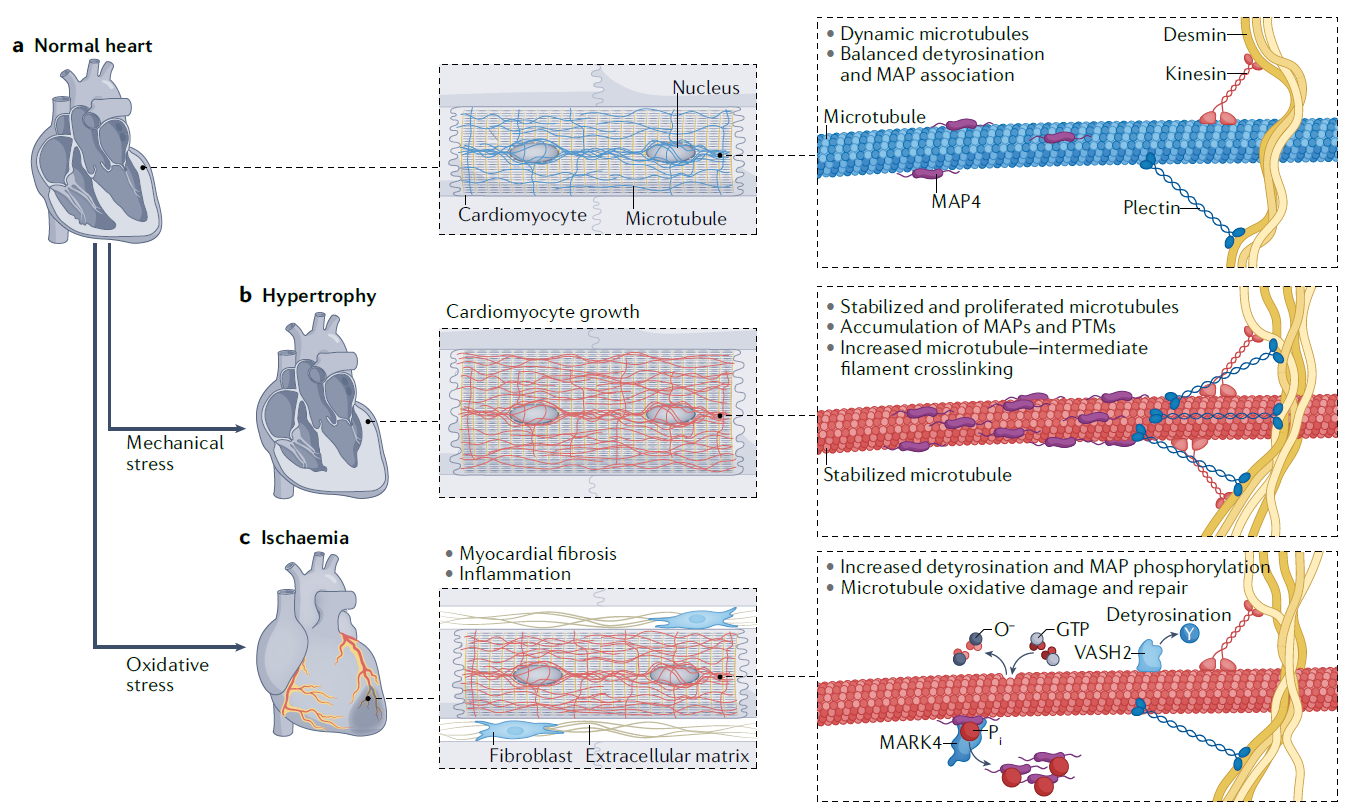 NatRevCardiolHeartFailure.PNG