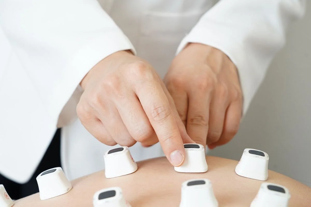 Fertility Acupuncture in Houston: Complete Guide to Natural Pregnancy Support