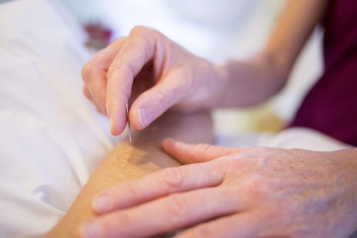 How Acupuncture Improves Egg Quality Naturally