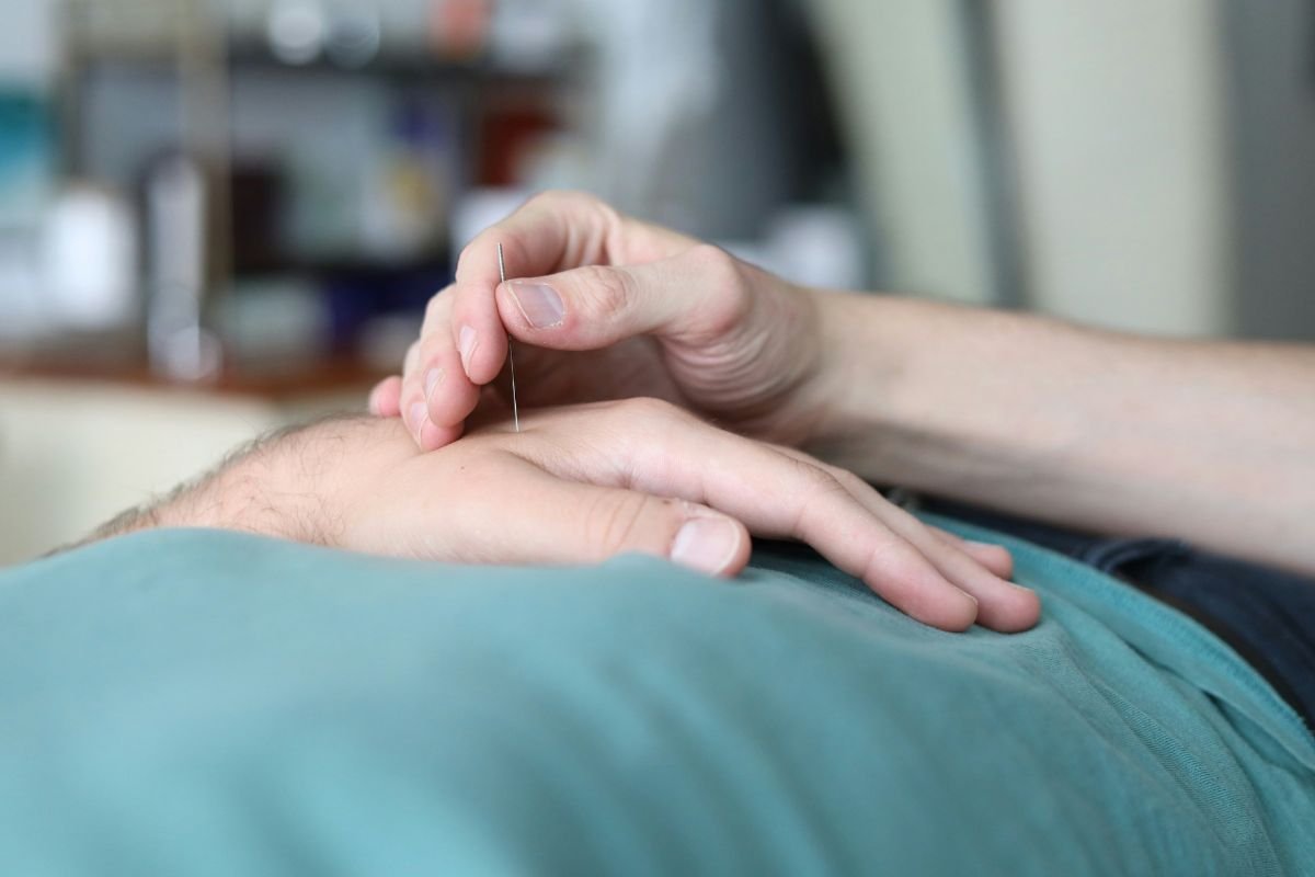 When to Start Acupuncture Before IVF Transfer: Expert Recommendations for Fertility Support