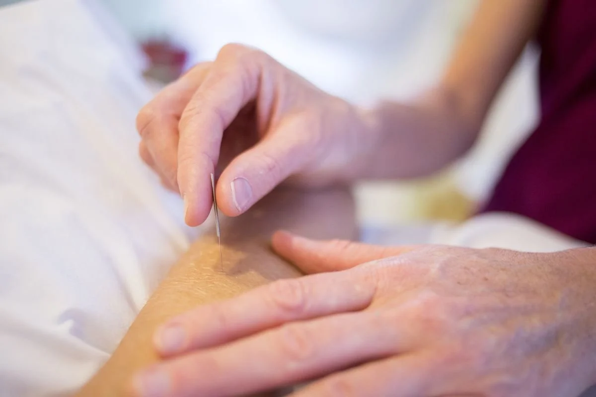 Acupuncture for IVF in Houston – Benefits, Cost, Timing Protocols &amp; More