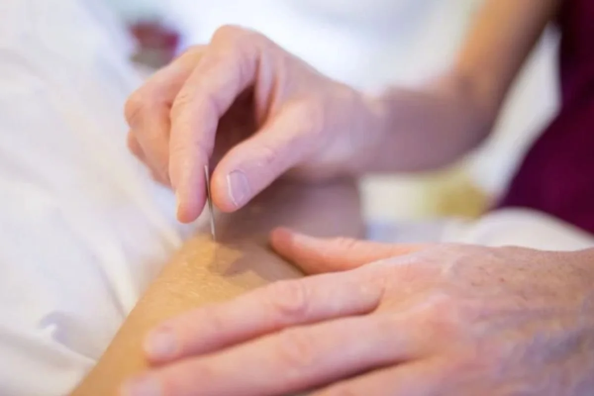 Acupuncture for IVF in Houston – Benefits, Cost, Timing Protocols &amp; More