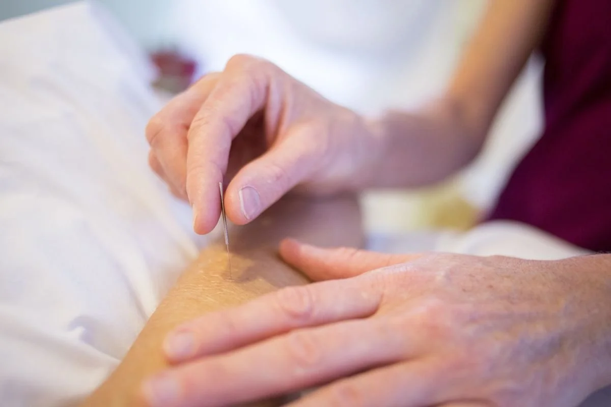 When to Start Acupuncture Before IVF Transfer