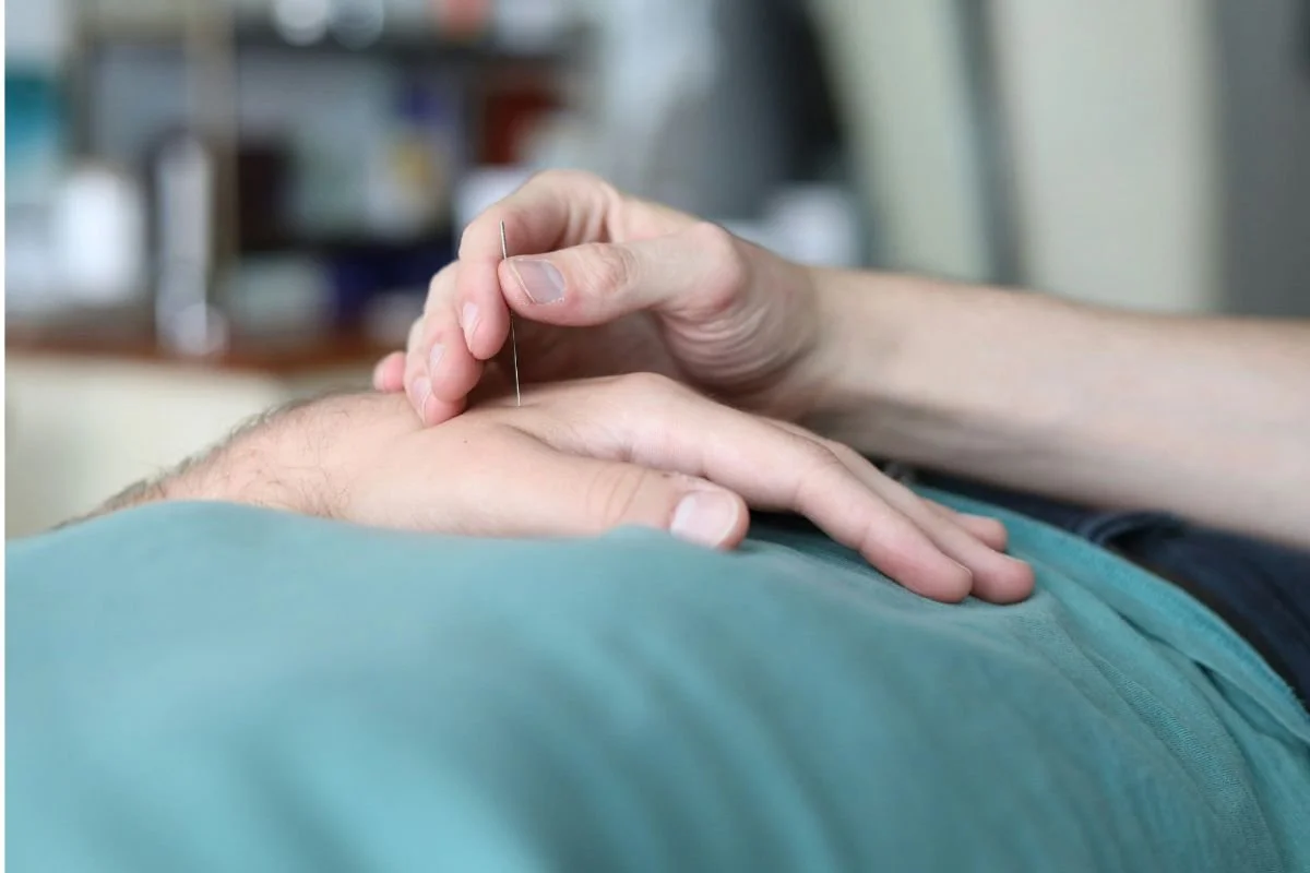 Acupuncture and Fertility Points