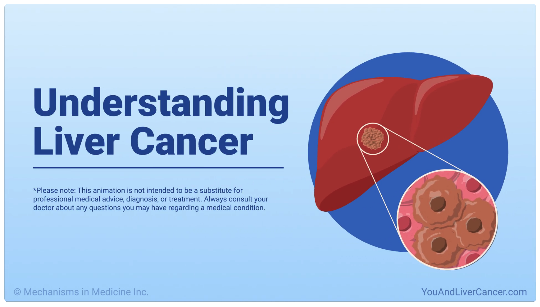 You and Liver Cancer