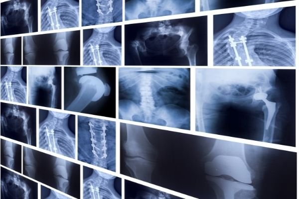 The Hidden Dangers of X-Ray Film: Why Proper Disposal Matters for Your Facility