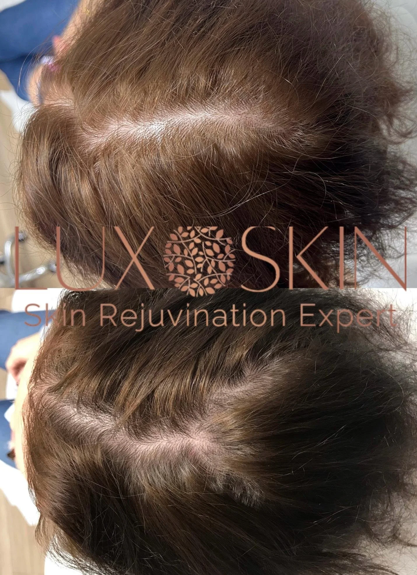 Hair-Restoration-Example-2.jpg