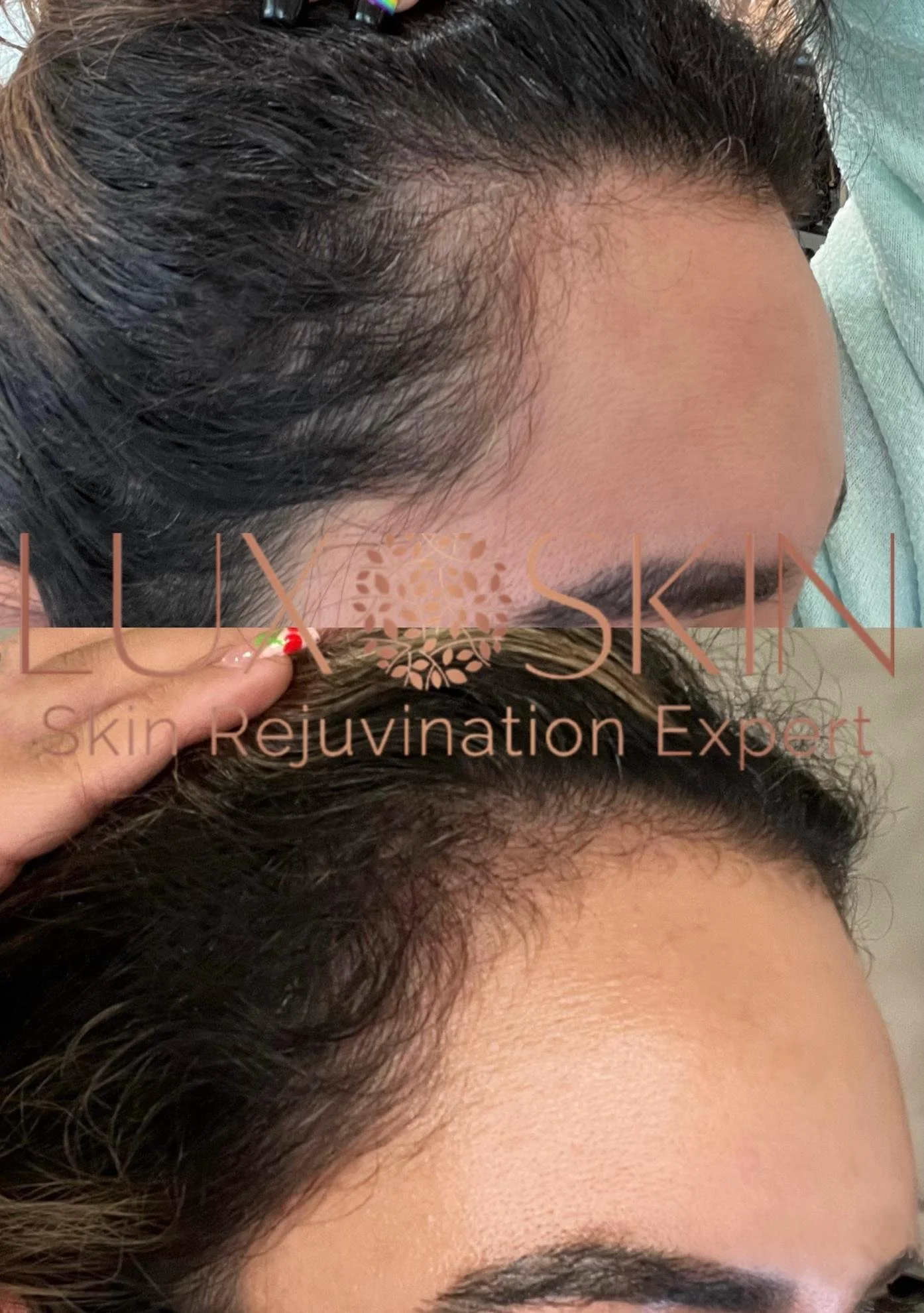 Hair-Restoration-Example-4.jpg