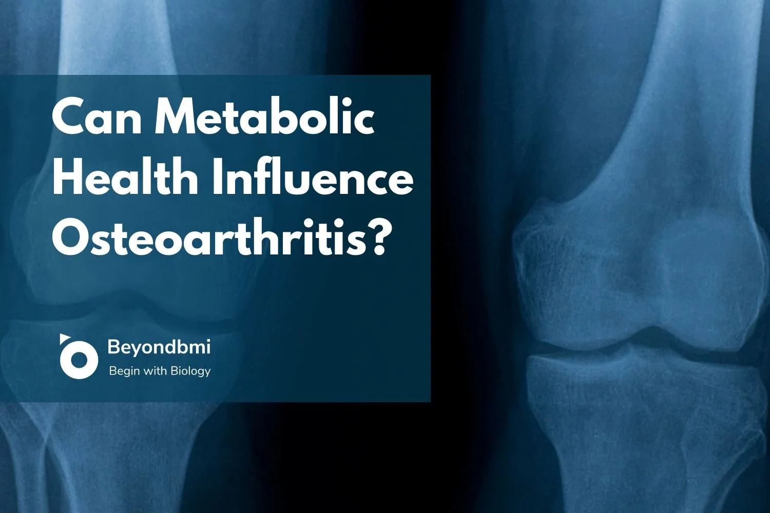 Can Metabolic Health Influence Osteoarthritis? New Research Explained