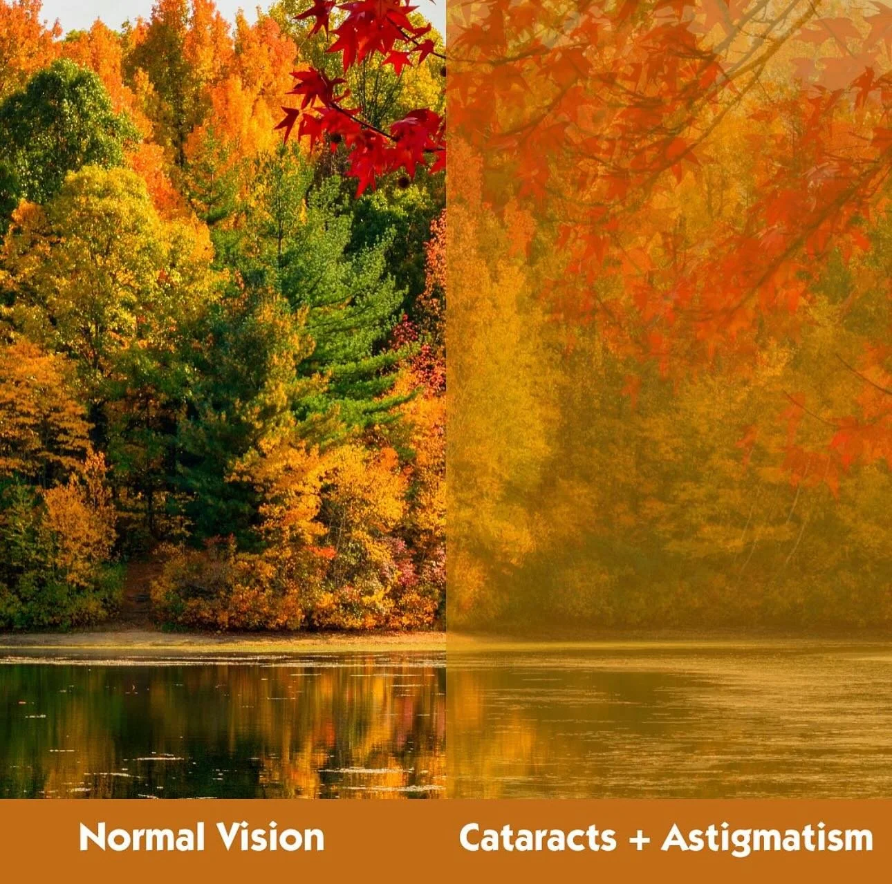 Comparison of a colorful autumn scene with trees and a lake, showing normal vision on the left and blurred, obscured vision with cataracts and astigmatism on the right.