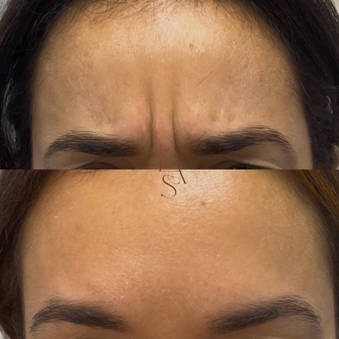 Before and After Instagram Post.PNG