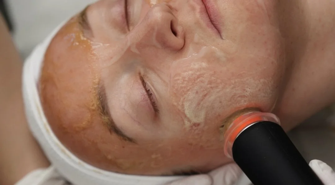 OxyGeneo Facials in the Hudson Valley